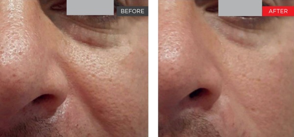 courtesy_of_fernandez_md