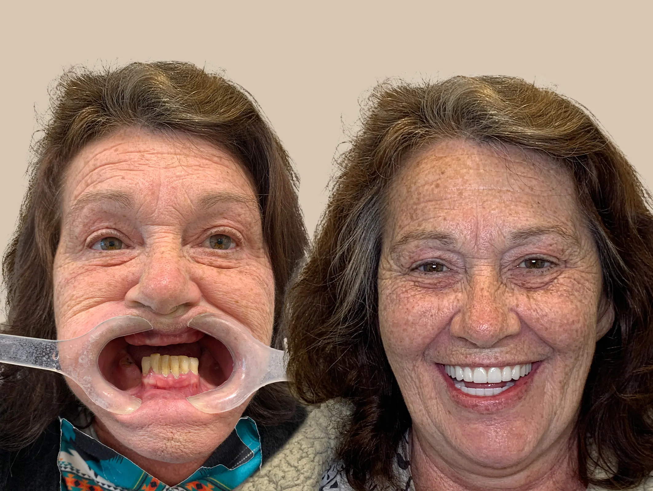 Alison Richards Retouched copy