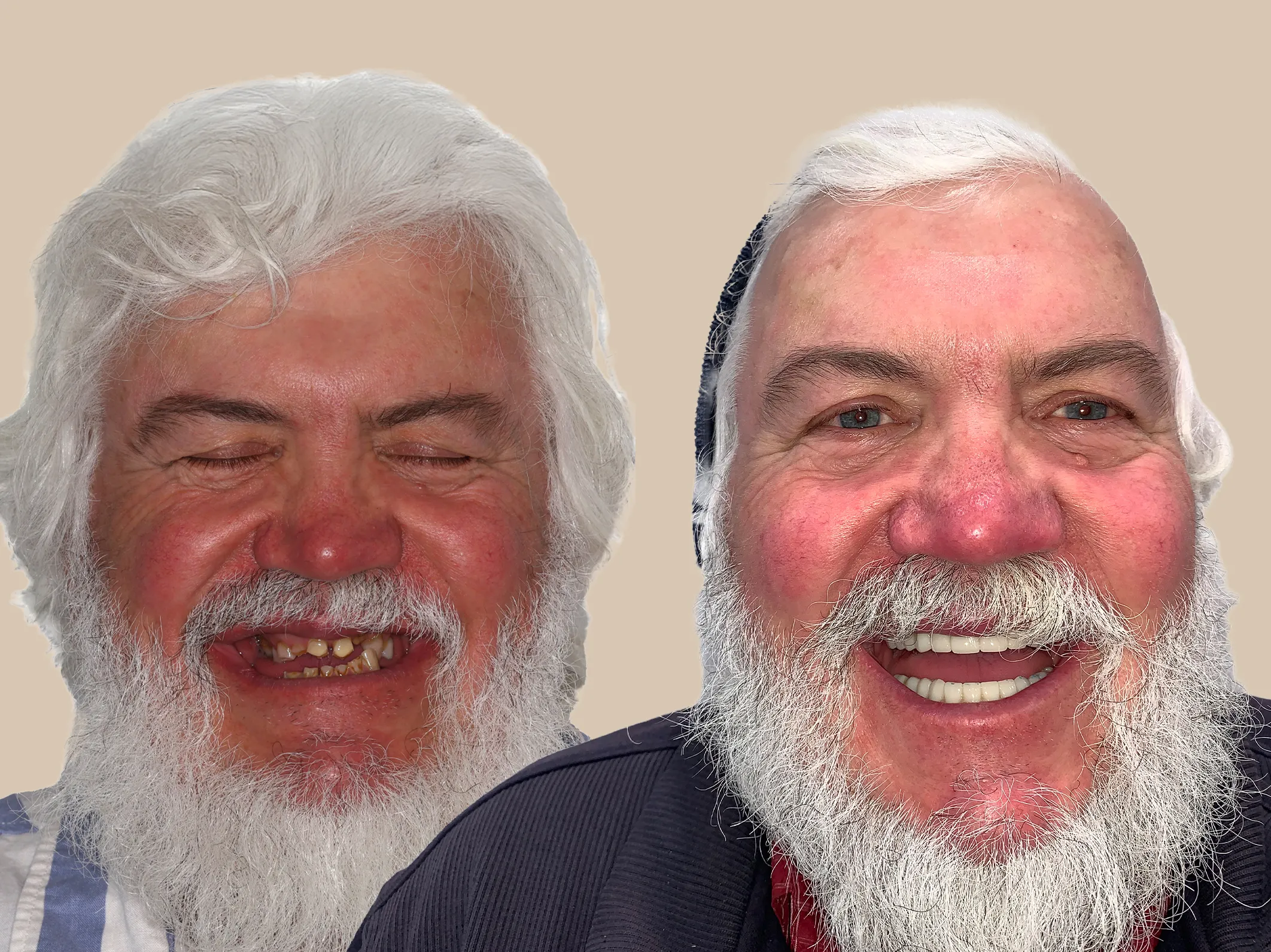 David Gries Retouched copy