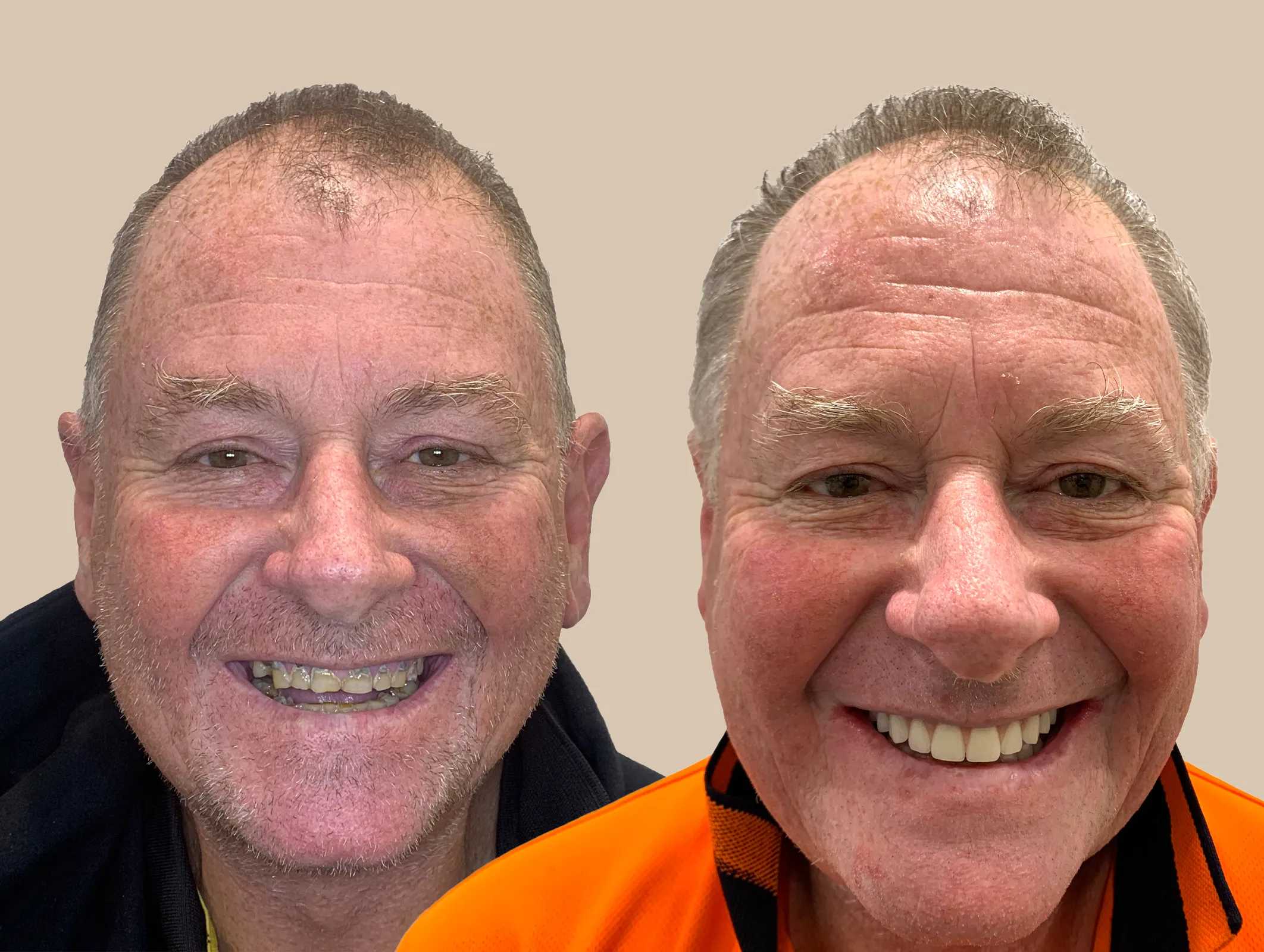 Euan Abell Retouched copy