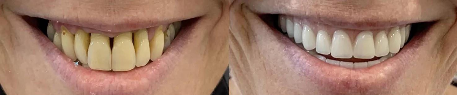 Jane Ewert Closeup copy