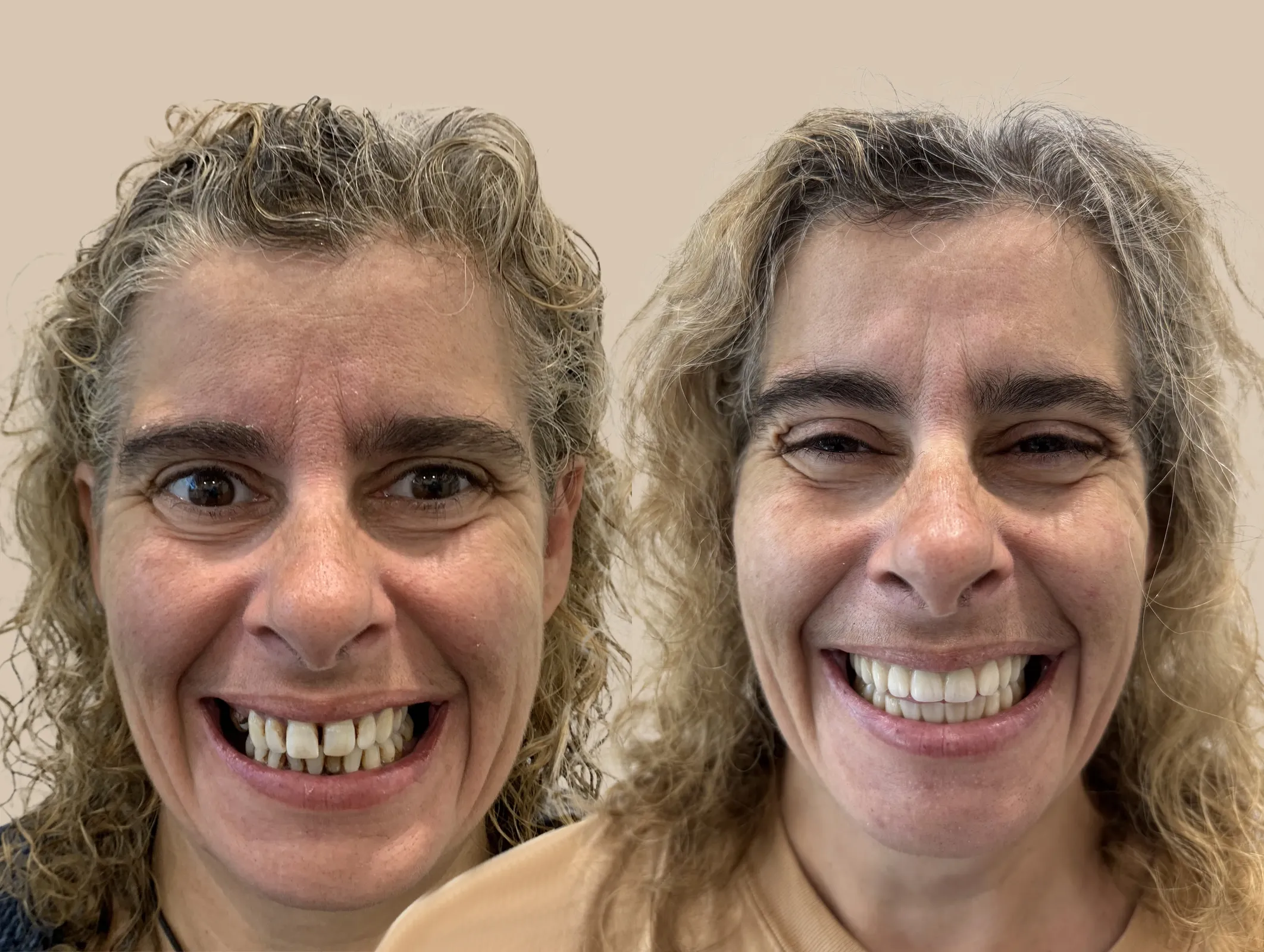 Lisa Burger Retouched copy