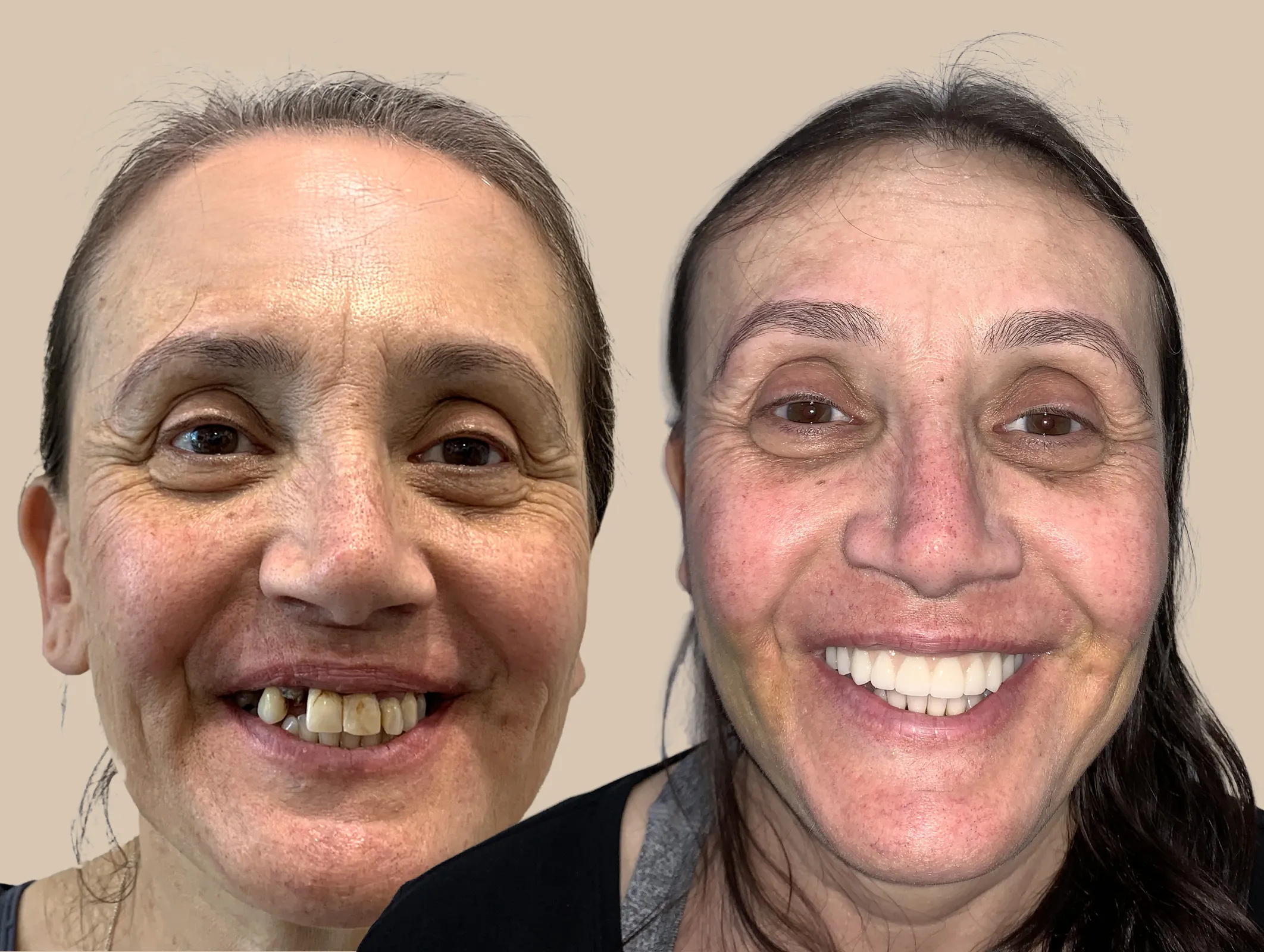 Panagiota Giannopoulos (Betty) Retouched copy 2