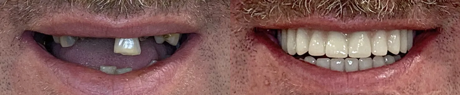 Stephan Louis Closeup copy