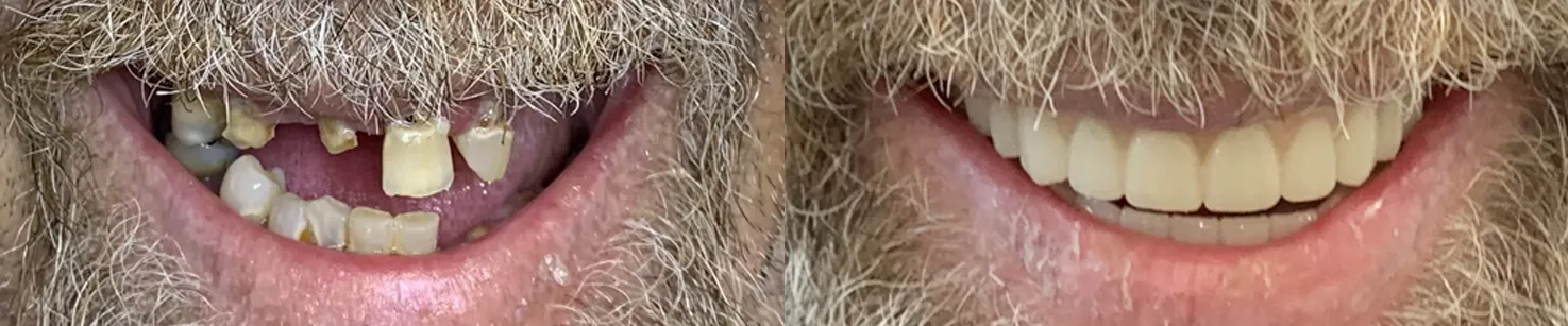 Wendy Neagle Closeup copy