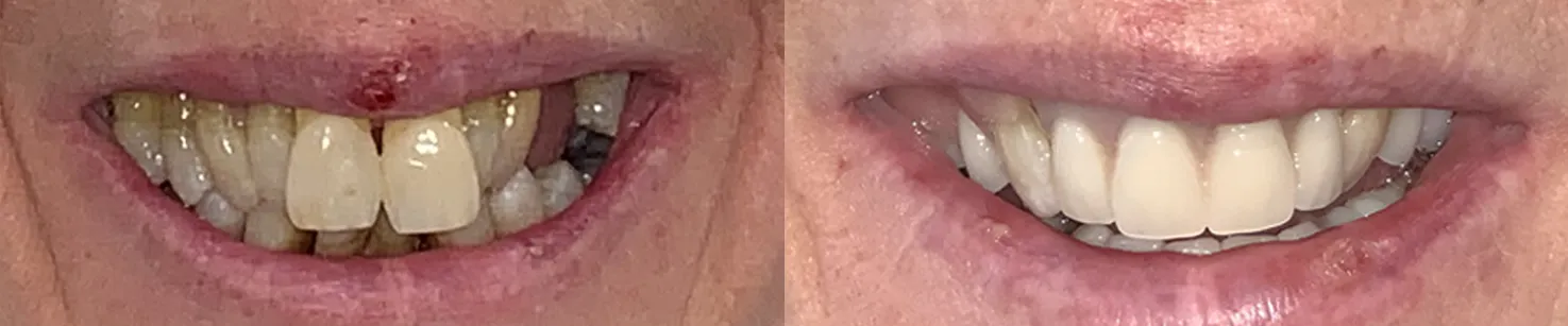 Wendy Neagle Closeup